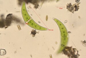 Closterium-moniliferum, Foto: LANUK/FB 55 Closterium-moniliferum, Foto: LANUK/FB 55